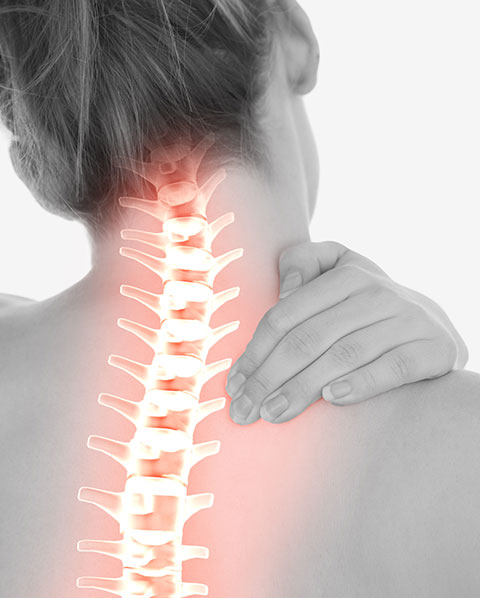 Pinched Nerve | Elevate Chiropractic | Chiropractic & Wellness Clinic | SW Calgary
